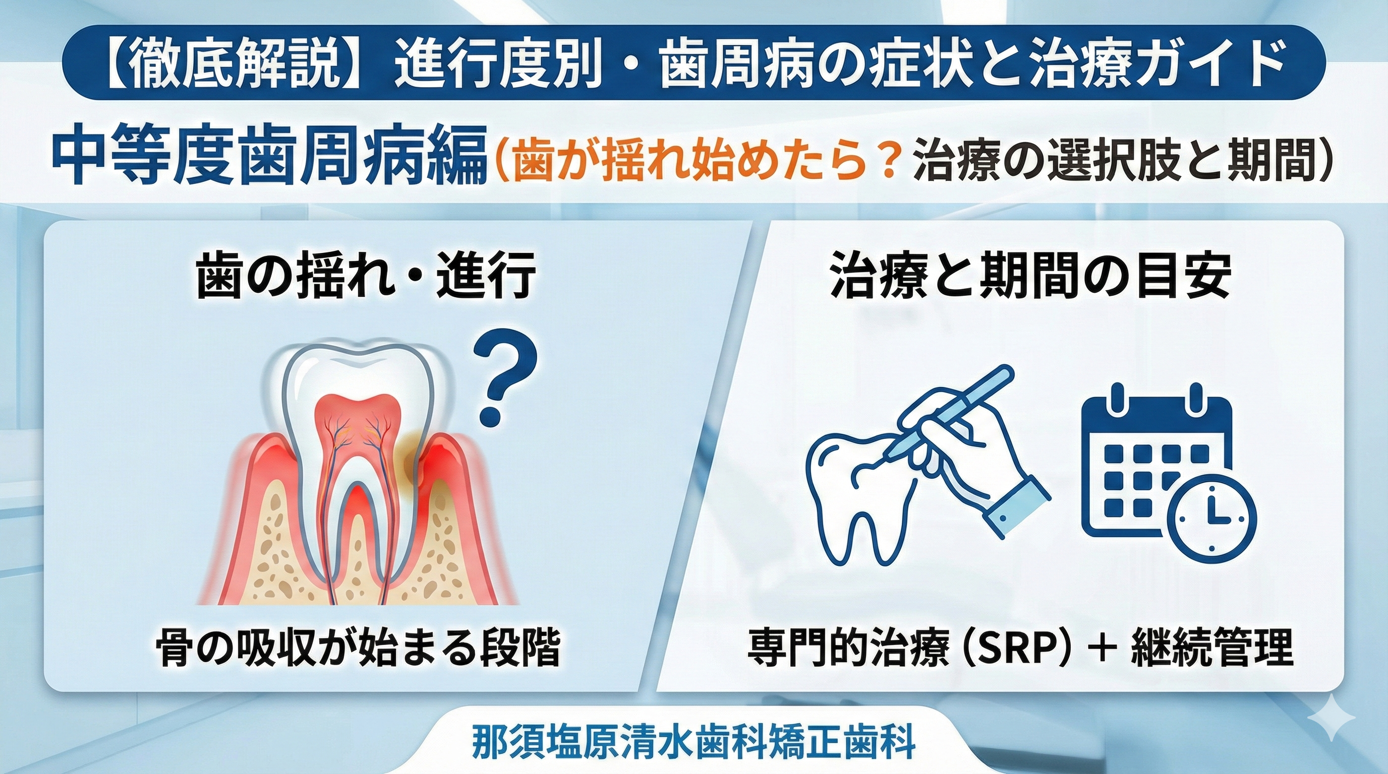 【徹底解説】進行度別・歯周病の症状と治療ガイド：中等度歯周病編（歯が揺れ始めたら？治療の選択肢と期間）